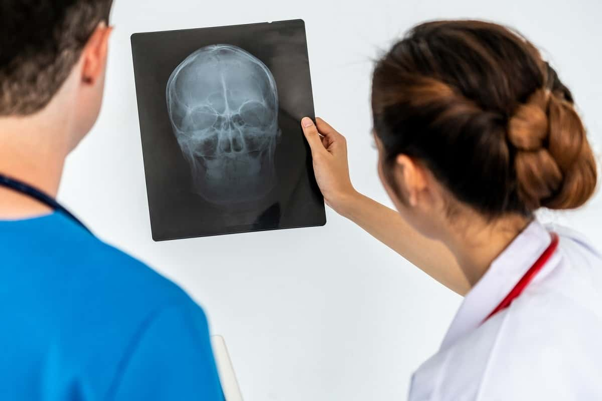 Two doctors looking at xray of skull